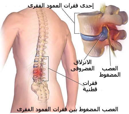 Image of cervical spine surgery